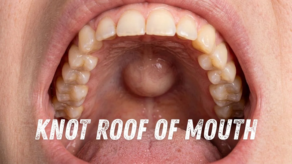 knot roof of mouth